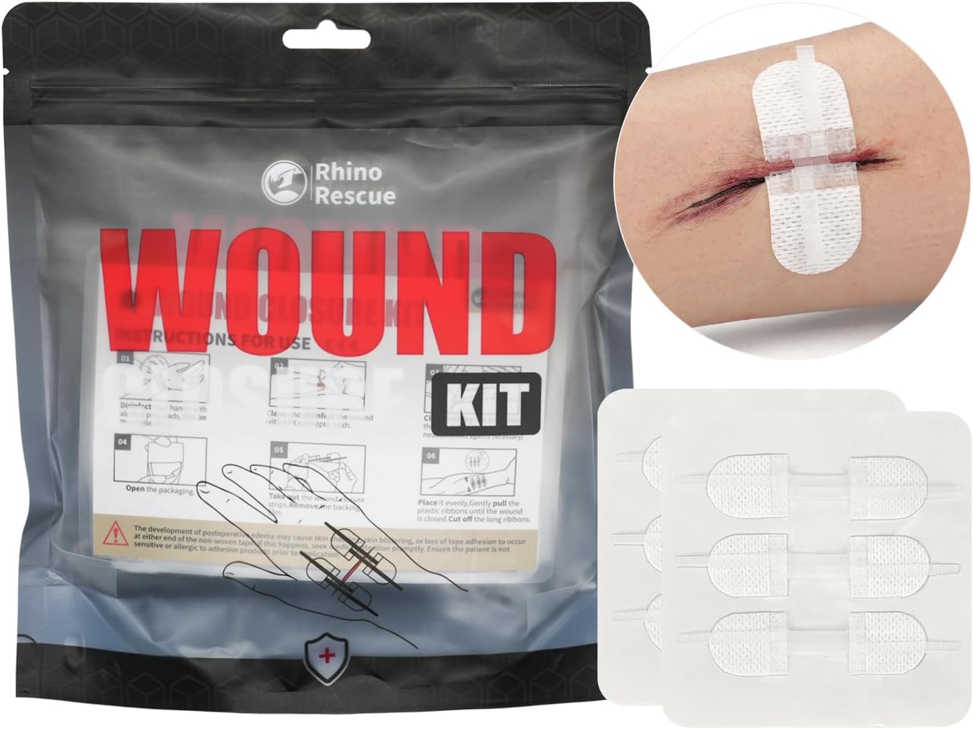 RHINO RESCUE Wound Closure Kits