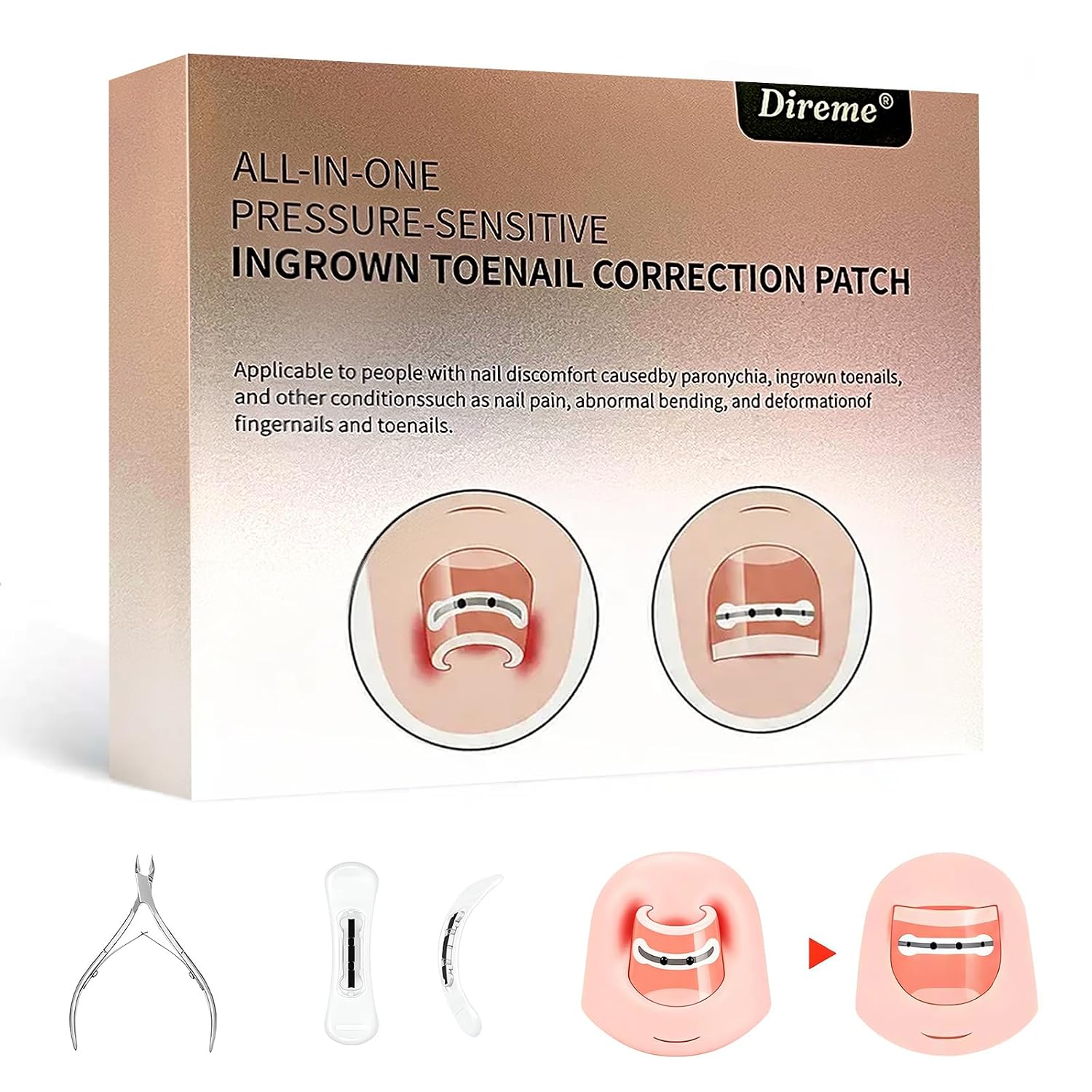 Direme Ingrown Toenail Correctors